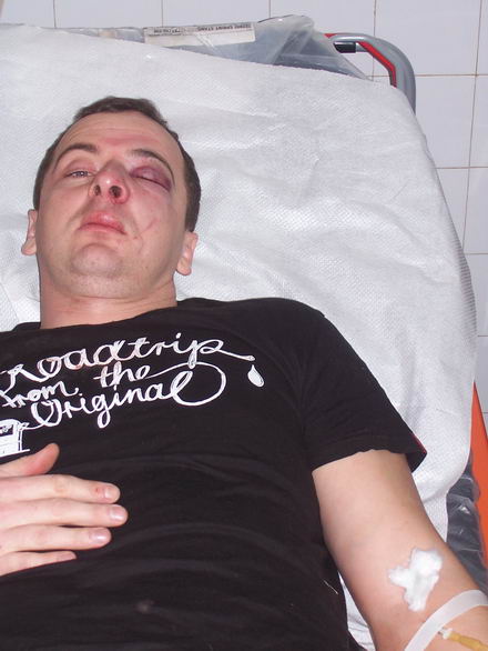 interlop_Eugen_Manea_batut.jpg