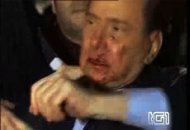 Berlusconi s-a ales cu nasul spart