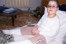 Copilul cu oase de sticla cauta oameni cu suflet de aur (document)