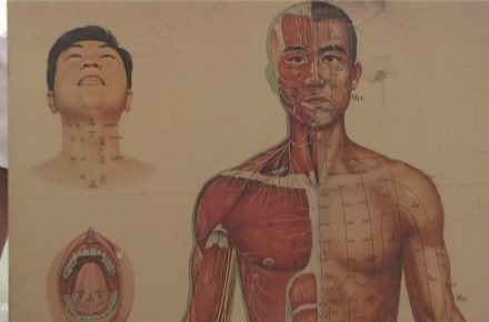acupunctura.jpg
