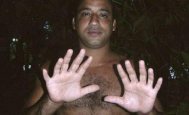 Un bărbat din Cuba are şase degete la fiecare mână şi la fiecare picior