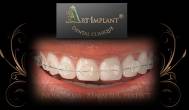 Clinica Dentară Art Implant Noi creăm zâmbetul perfect 