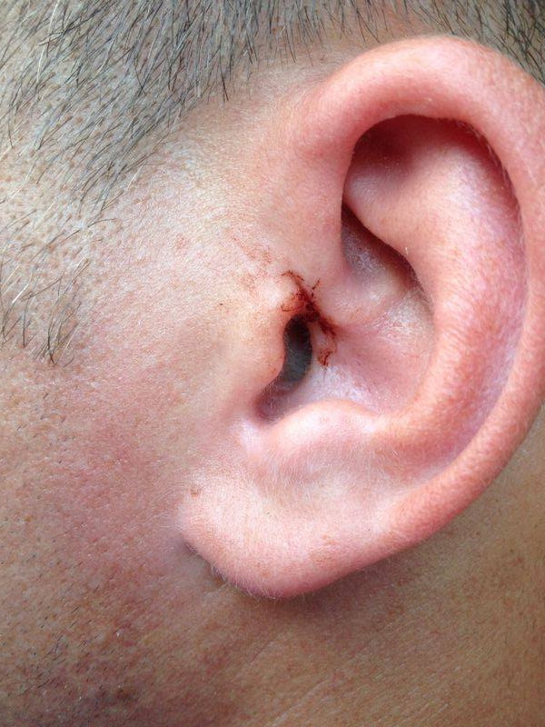 arbitrul laurentiu ciuchita batut la meci sub ochii prietenei sale si ai copilului acesteia opriti va arbitrul laurentiu ciuchita batut la meci sub ochii prietenei sale si ai copilului acesteia opriti va