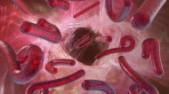 MAE a emis o nouă atenţionare de călătorie din cauza virusului Ebola  