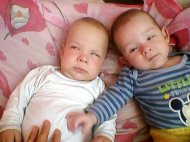 Apel umanitar Doi gemeni au nevoie de ajutor pentru a vedea