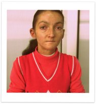 Apel umanitar Oana Speranţa Stoica  suferă de o maladie rară care îi macină pielea și oasele