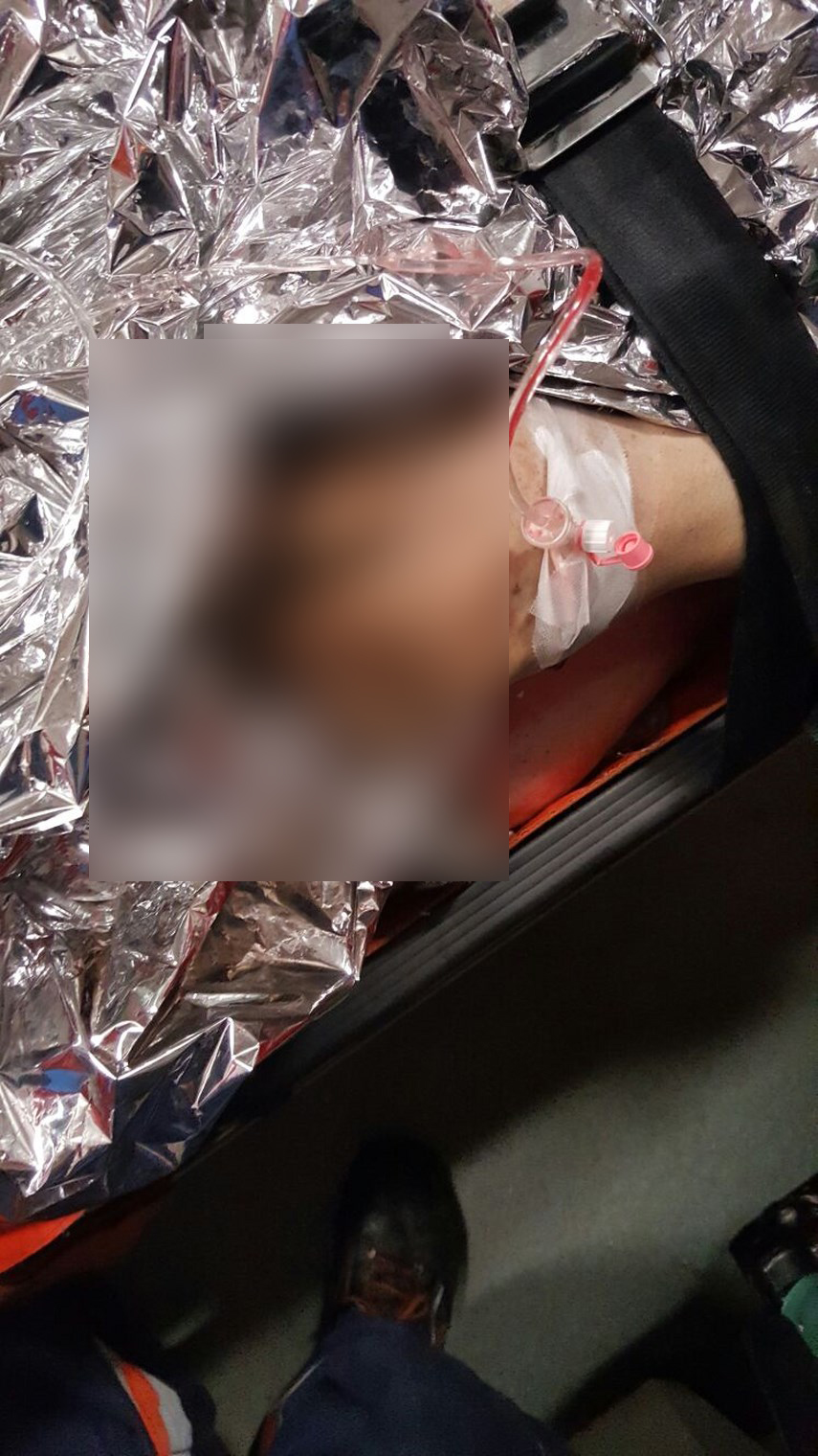 o persoana ranita in urma unei explozii din zona elvila din constanta 597593 o persoana ranita in urma unei explozii din zona elvila din constanta 597593