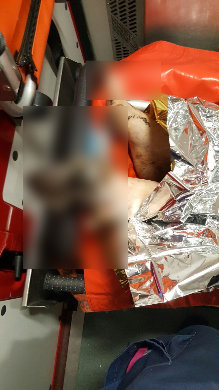 o persoana ranita in urma unei explozii din zona elvila din constanta 597593 o persoana ranita in urma unei explozii din zona elvila din constanta 597593