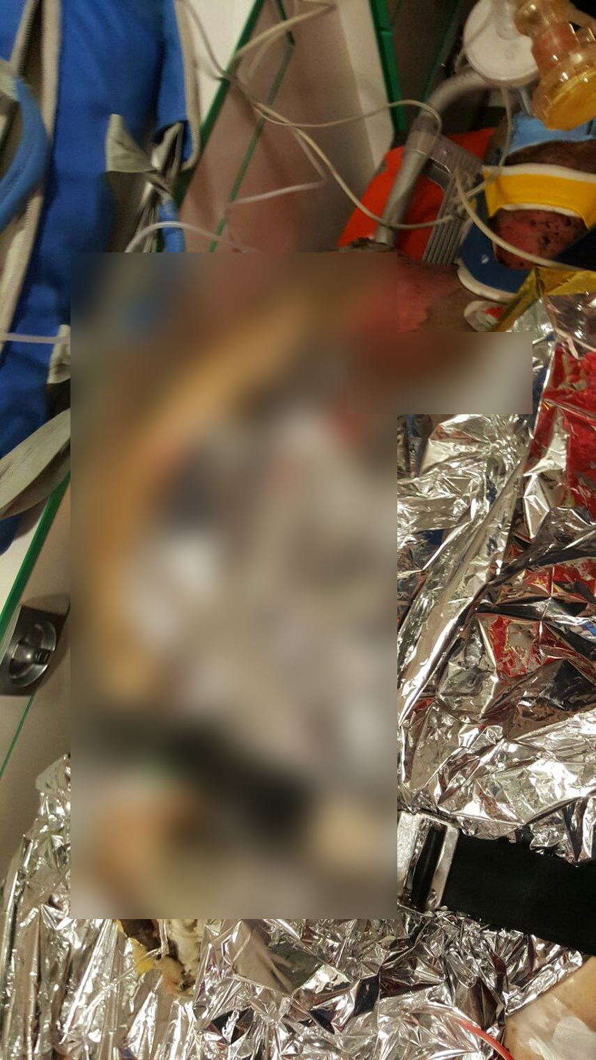 o persoana ranita in urma unei explozii din zona elvila din constanta 597593 o persoana ranita in urma unei explozii din zona elvila din constanta 597593