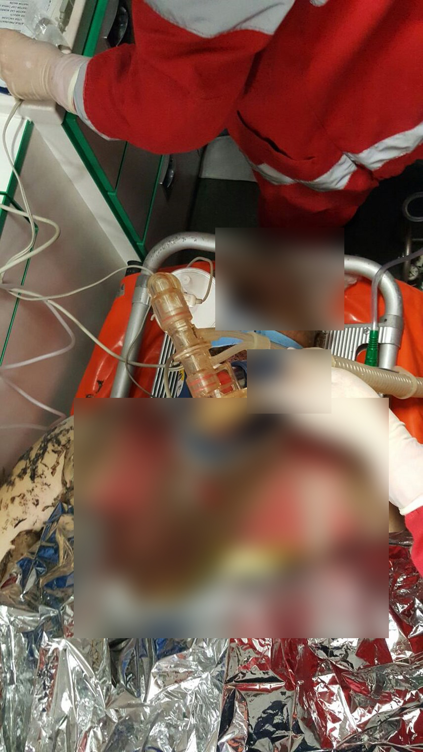 o persoana ranita in urma unei explozii din zona elvila din constanta 597593 o persoana ranita in urma unei explozii din zona elvila din constanta 597593