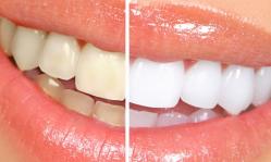 Vă oferim 40 de utilizări extraordinare ale bicarbonatului de sodiu  