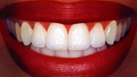 StudiuUn român din cinci a rămas fără dantură