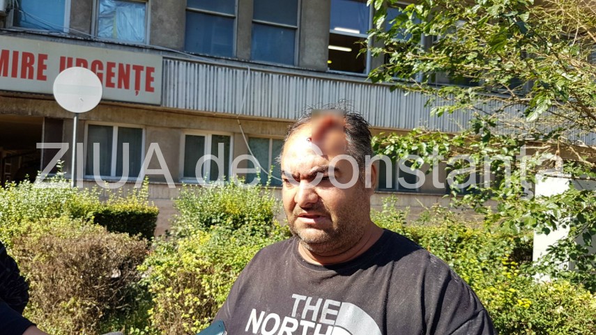 barbatul calcat cu masina si lovit cu un par la constanta a facut declaratii de la ce a pornit incidentul barbatul calcat cu masina si lovit cu un par la constanta a facut declaratii de la ce a pornit incidentul