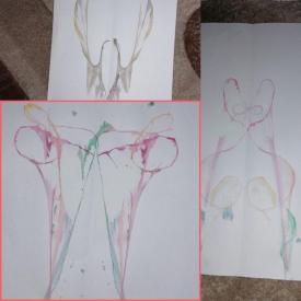 Apel umanitar pentru o fetiță din Constanța diagnosticată cu cancer. „Licitație” pe Facebook pentru cazul Alexandrei (galerie foto)